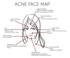 Acne Face Map
